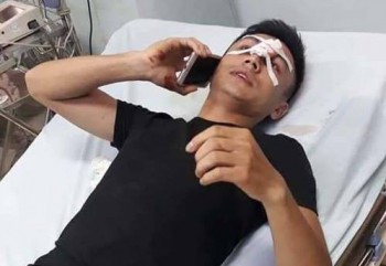 Nam thanh niên 'tự ý chảy máu mũi' sau khi giằng co điện thoại với CSGT