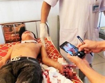 Hà Tĩnh: Đang học bài, laptop bất ngờ phát nổ khiến 3 học sinh nhập Học sinh phải nhập viện cấp cứu trong tình trạng bị nổ nát bàn tay trái.