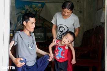 Bố tật nguyền, mẹ thiểu năng, thương bé trai 4 tuổi mắc bệnh hiểm nghèo