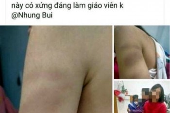 Hải Phòng: Xử lý nghiêm giáo viên chủ nhiệm bị tố đánh học sinh lớp 1