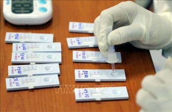 Ngày 15/2, Việt Nam có 31.814 ca nhiễm mới SARS-CoV-2, có 2.926 ca nặng đang điều trị