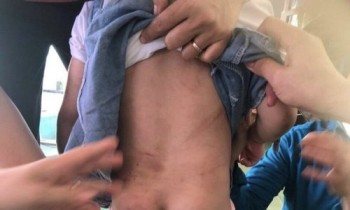 Khởi tố vụ án dì ruột dùng chổi sắt đánh cháu bé 4 tuổi nhập viện ở Hà Tĩnh