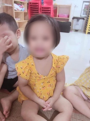 Tin buồn: Bé gái 3 tuổi bị nhân tình của mẹ đóng đinh vào đầu đã tử vong