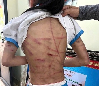 Bắt giữ gã cha dượng bạo hành dã man bé gái lớp 5 ở Hà Tĩnh